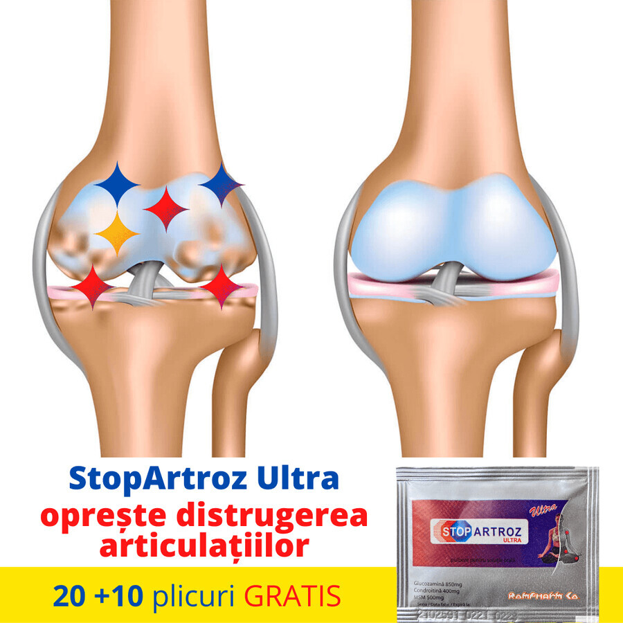 Stopartroz Ultra, 30 sachets, Rompharm