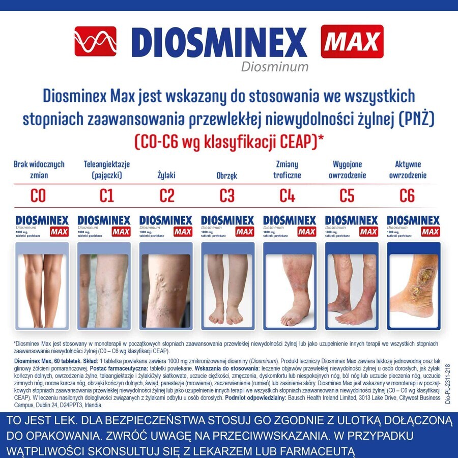 Diosminex Max 1000 mg, 60 comprimate