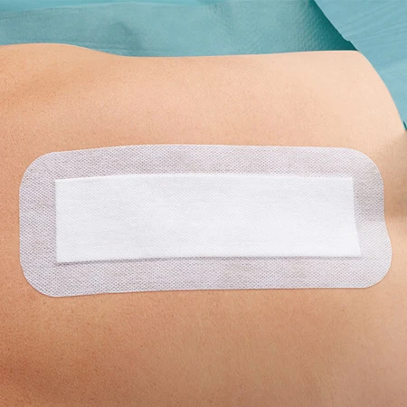 Cosmopor E, surgical dressing, sterile, 35 cm x 10 cm, 25 pieces