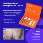 Vitumisil Anti-Acne Kit, Gesichtsschaum 100 ml + Gesichtswasser 100 ml + Tagescreme 50 ml + Nachtcreme 50 ml