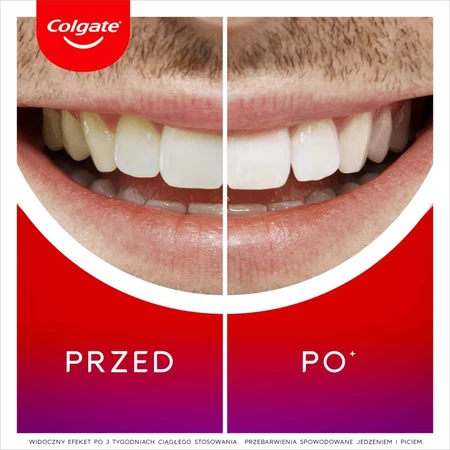 Colgate Max White Overnight, witmakende applicator, 2.5 ml