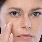 Dermedic Melumin, depigmentatieserum, 30 ml