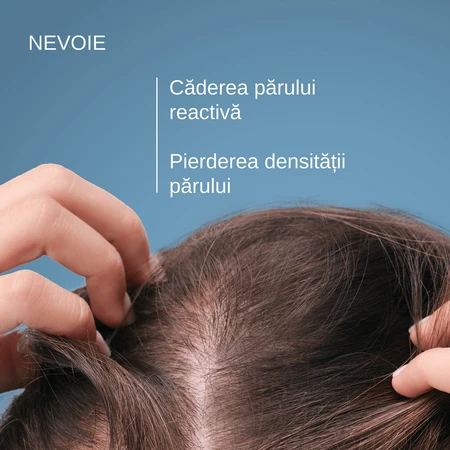 Shampoo Anaphase contro la caduta dei capelli, 400 ml, Ducray