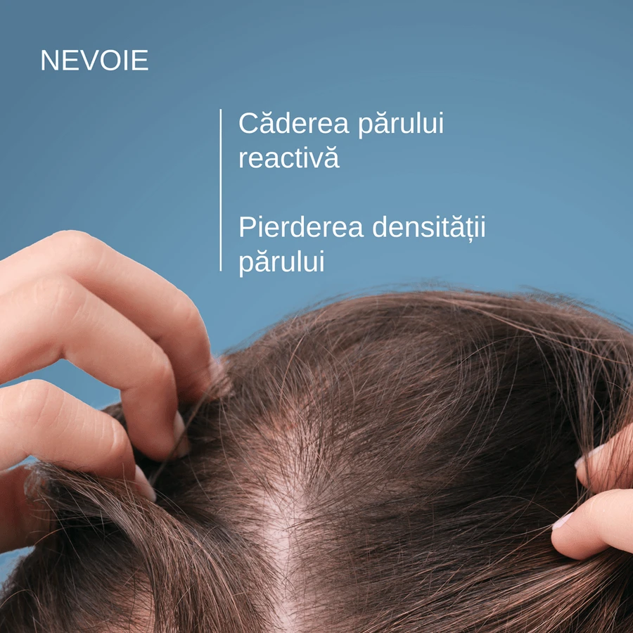 Shampoo Anaphase contro la caduta dei capelli, 400 ml, Ducray