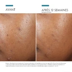 Skinceuticals Hydraterende corrigerende verzorging voor een egale en stralende teint 30ml