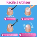 Excilor Tratamiento Hongos Uñas Fuerte 30ml