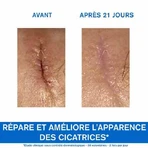 Uriage Bariéderm-Cica Repair Cream Met Cu-zn Bariederm Geïrriteerde Huid Peaux Fragilisees 100ml