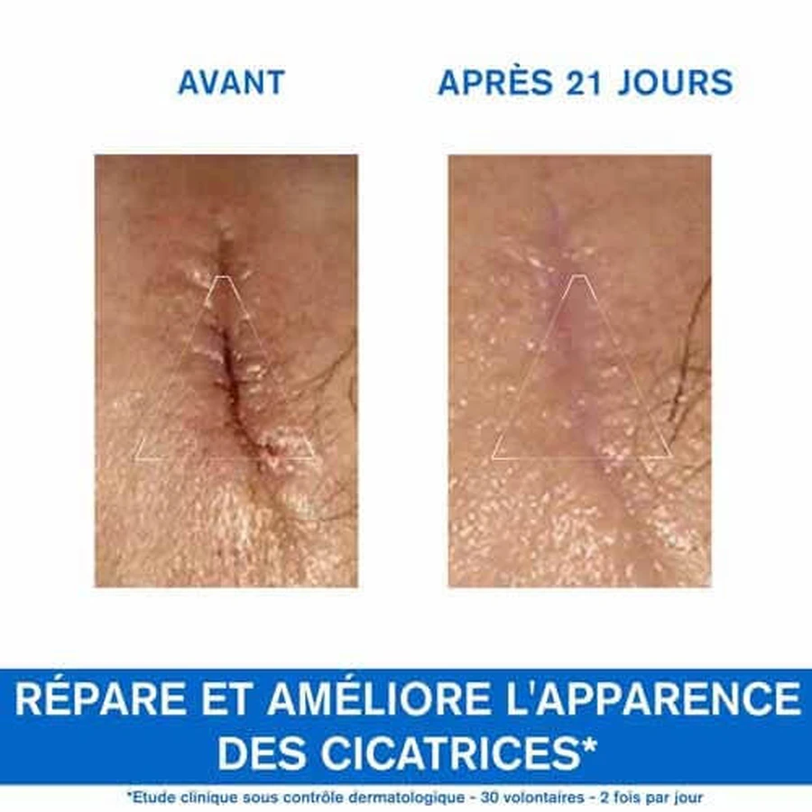 Uriage Bariéderm-Cica Repair Cream Met Cu-zn Bariederm Geïrriteerde Huid Peaux Fragilisees 100ml
