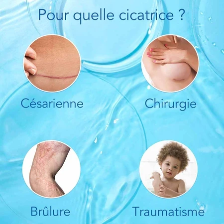 Kelo-cote Narbenbehandlung Spray 100ml