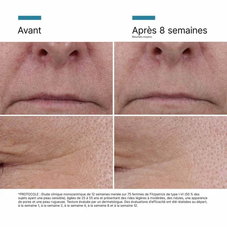 Skinceuticals P-Tiox Serum Péptido Corrector de Arrugas 30ml