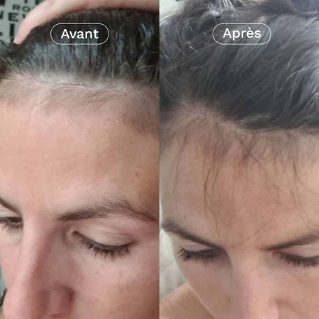 Omum Mon Coup de Pousse Nutricosmétique 60 gélules