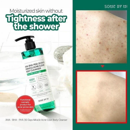 Some By Mi 30 DAYS MIRACLE Gel Corps 400gr