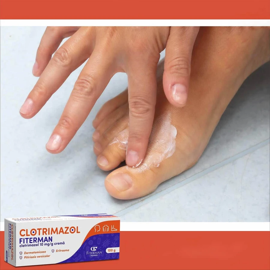 Clotrimazole cream 10 mg/g, 100 g, Fiterman