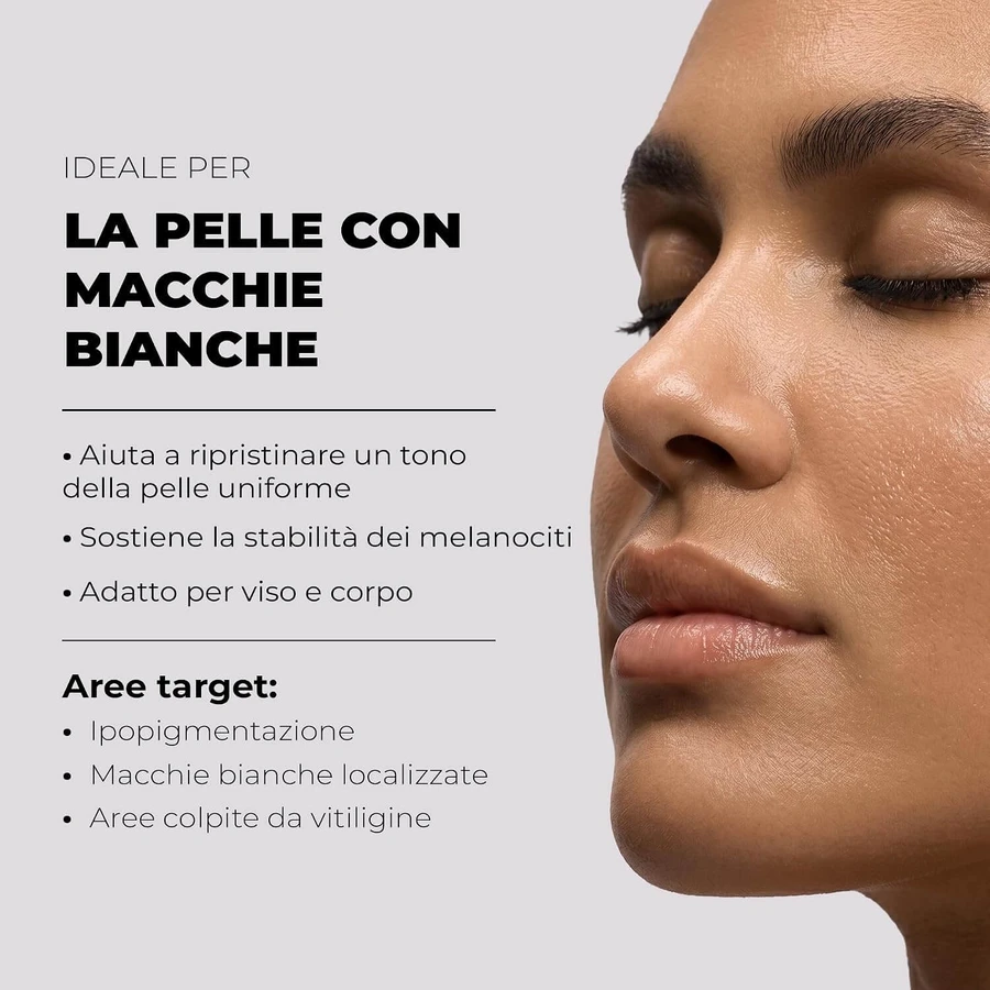 Bella aurora repigment12 crème repigmentante 75 ml