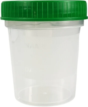 Biocanto Urinecontainer 100 ml steriel 1 stuk