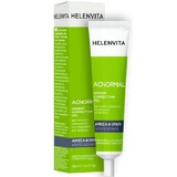Helenvita | Gel voor lokale toepassing tegen vlekken | 15ml