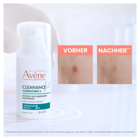 Avène Cleanance pieles con imperfecciones 1 lote