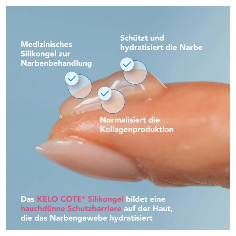 Kelo-cote Silikon Gel zur Behandlung von 15 g