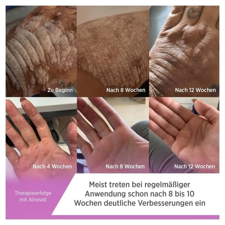 ALNOVAT Crème 100 g