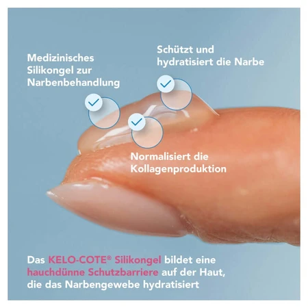 Kelo-cote Kids Silikon Narbengel 6 g