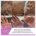 ALNOVAT Crème 50 g