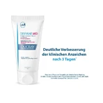 Ducray DEXYANE MeD Crema 30 ml