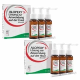 Alopexy 5% Lösung, 3X60 ml Lösung