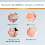 EndWarts® CLASSIC Lösung, 3 ml Lösung