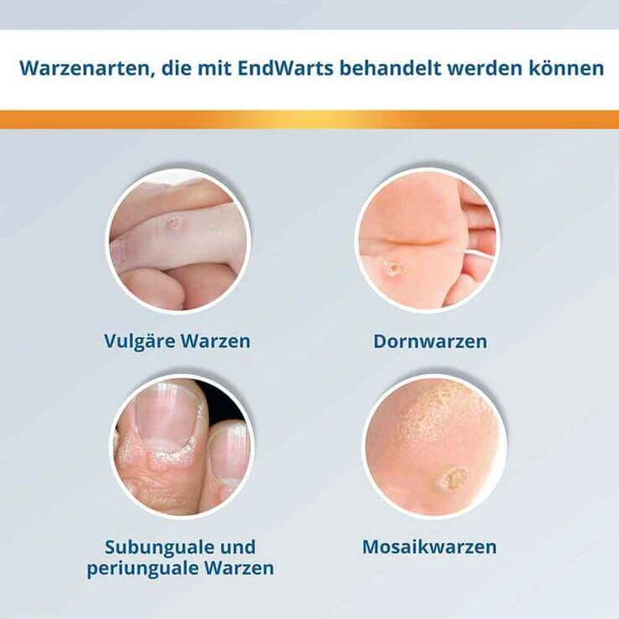 EndWarts® CLASSIC Lösung, 3 ml Lösung