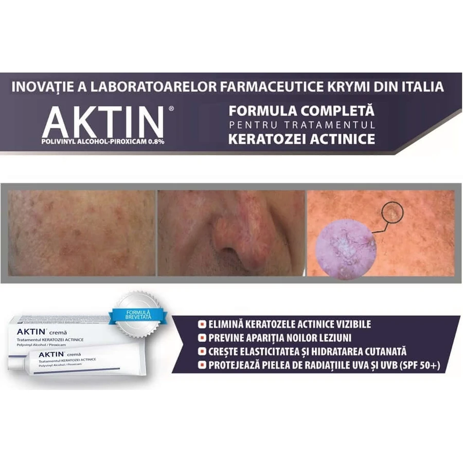 Krem Aktin do leczenia rogowacenia słonecznego i zmian przedrakowych, 2 x 30 ml, Solartium: ceny i cechy