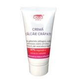 Gebarsten calcae crème, 50 ml, Ceta Sibiu, Ceta Sibiu
